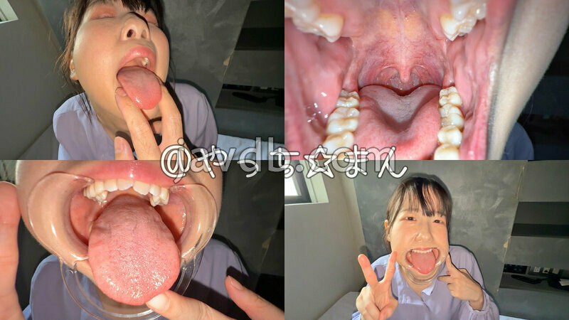 Y-304 【個人撮影】谷田かりな 開口器で口内観察デカ舌を要チェック