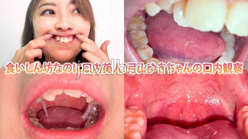 NKO-084 食いしん坊なのに口内美人!弓山ゆきちゃんの口内観察