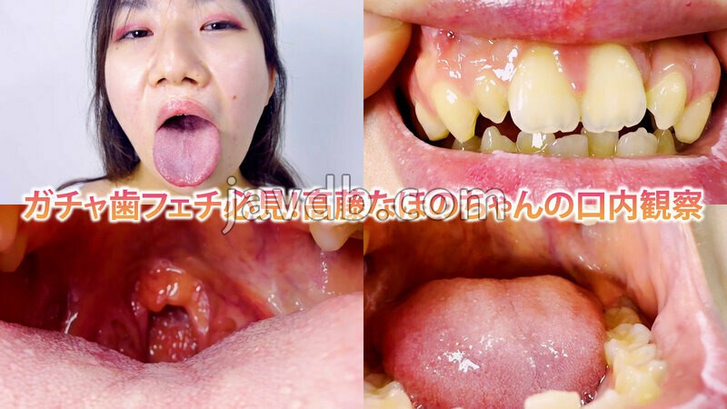 NKO-083 ガチャ歯フェチ必見！高藤なほのちゃんの口内観察