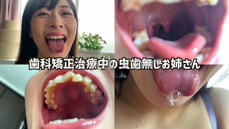 NKO-063 街角で声をかけて口内観察させてもらう ファーストフード店パート みおりさん