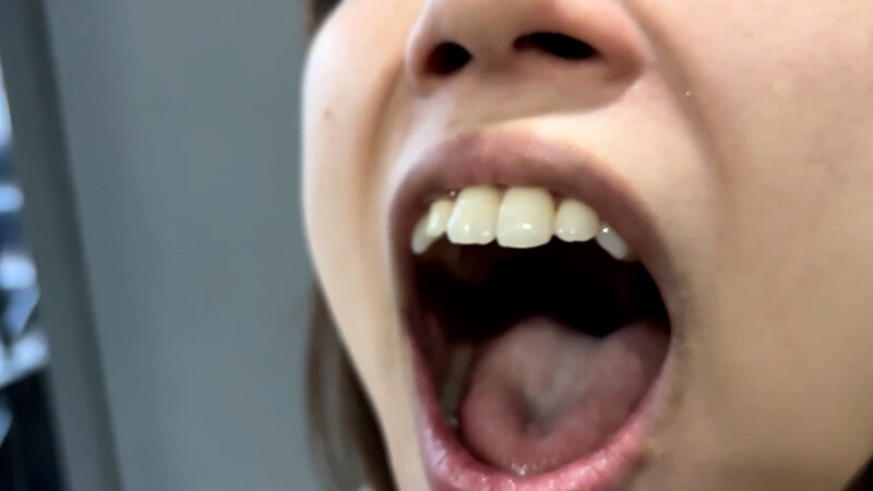NKO-30000 Samples 11