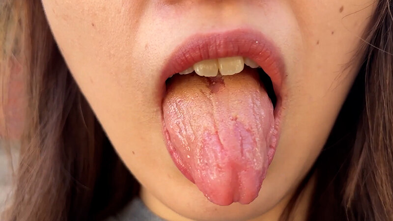 NKO-003 Samples 2