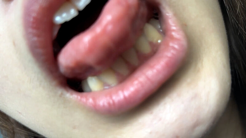 NKO-003 Samples 4