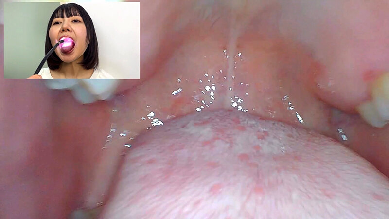 NKO-066 Samples 11