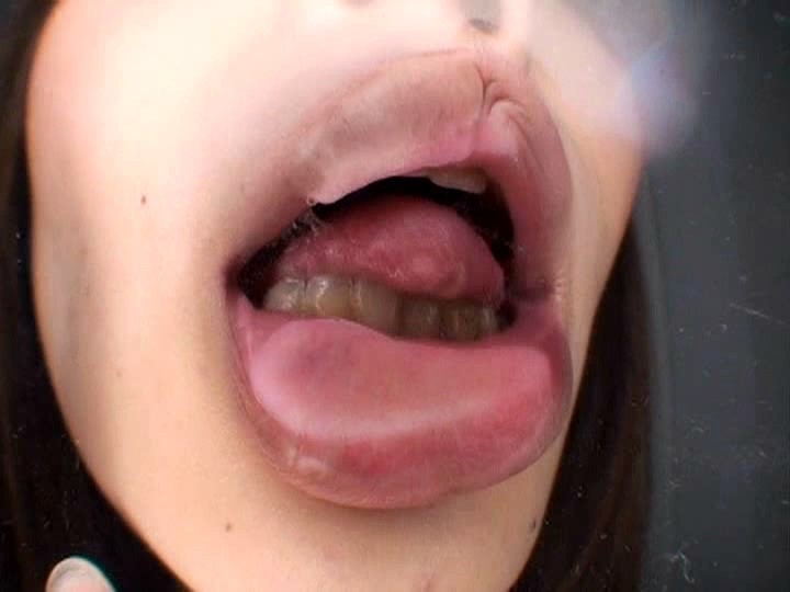 C-1384 샘플 11