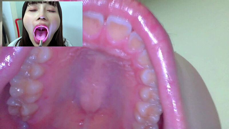 NKO-005 Samples 4