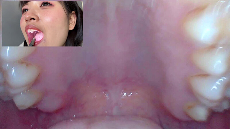 NKO-005 Samples 9