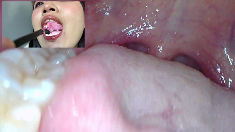 NKO-005 Samples 10