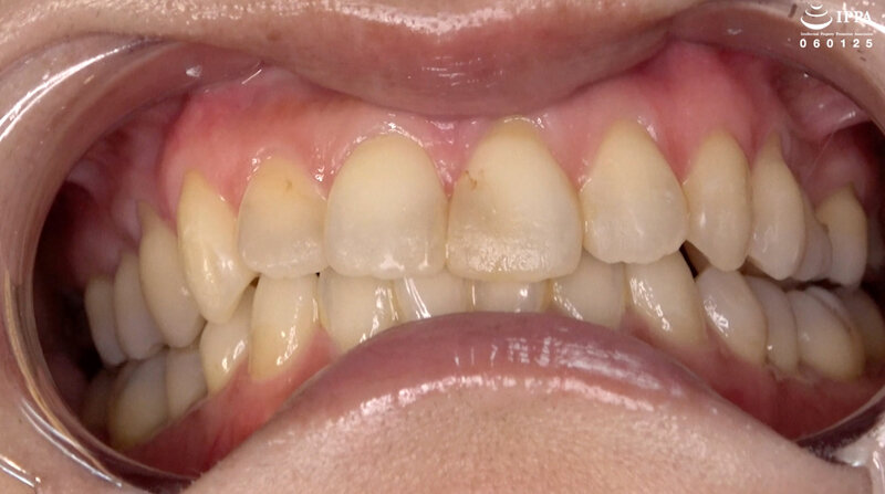 AD-1840 샘플 3