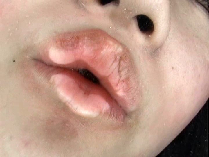 C-1462 샘플 12