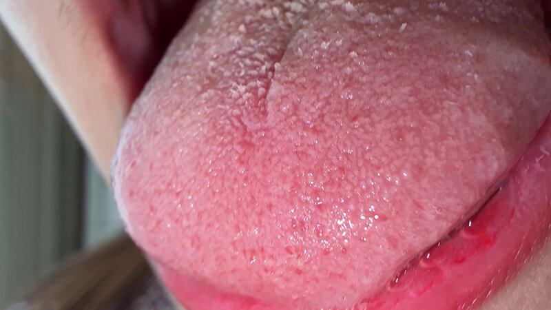 Y-369 샘플 12