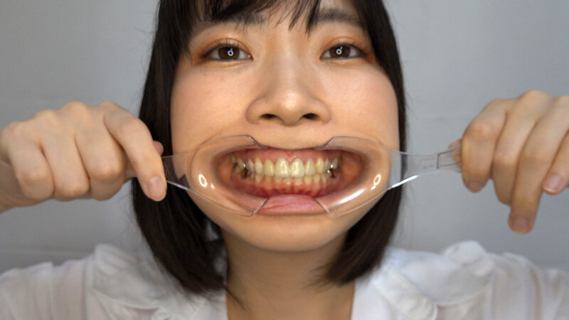 ROP-017 Samples 11