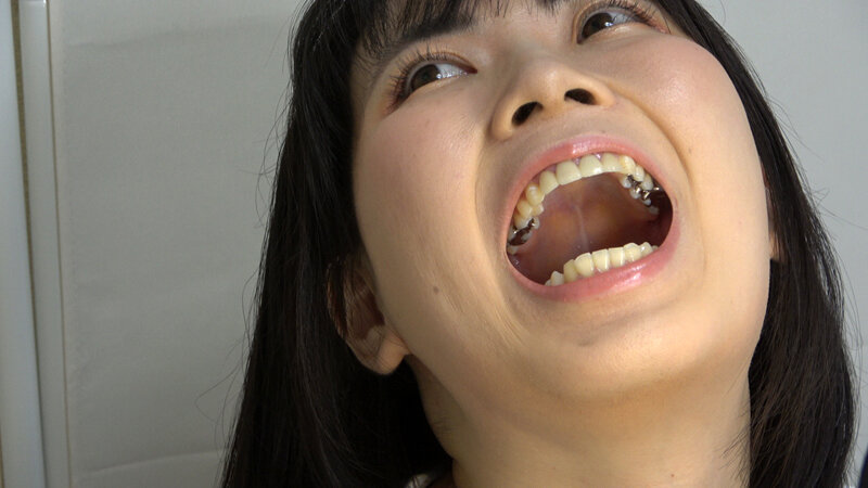 ROP-017 Samples 7