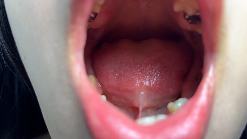 NKO-074 Samples 3