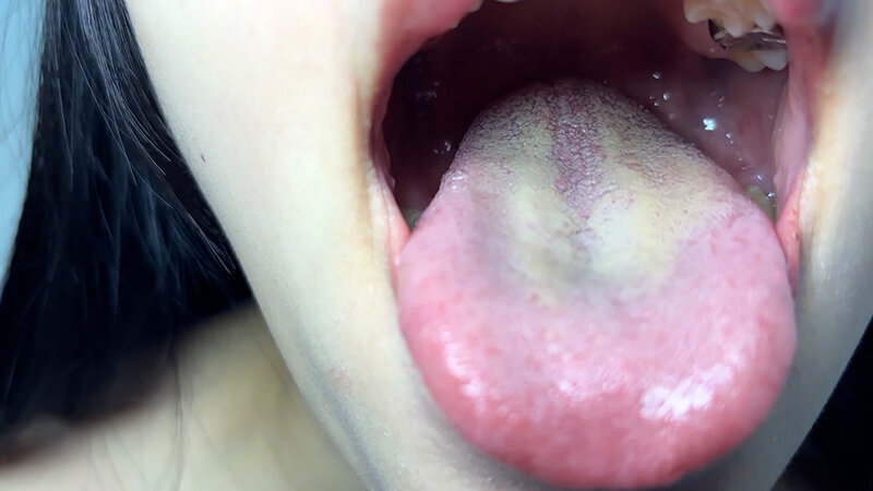 NKO-074 Samples 4